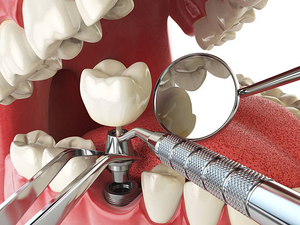 Best Broken or Cracked Tooth Emergency Dentist in Kyle, SD