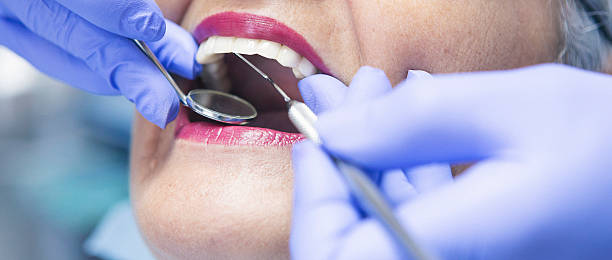 Best Emergency Dental Extractions in Kyle, SD